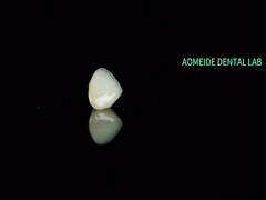 Pont de la couronne en céramique