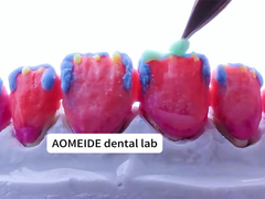 Résistance Esthétique naturelle Couronne en zirconium solide Parfait pour une ou plusieurs dents