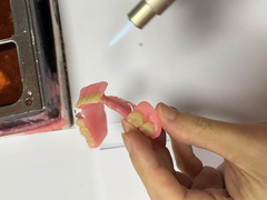 Prothèse dentaire amovible confortable adaptée à la solution de mastication sécurisée avec stabilité réglable