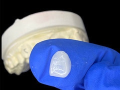 IPS e.max Veneurs pour incisif à l'ombre A1 Esthétique naturelle pour un sourire parfait