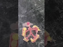 Prothèse partielle flexible Nesbit pour le confort et la durabilité de la prothèse dentaire