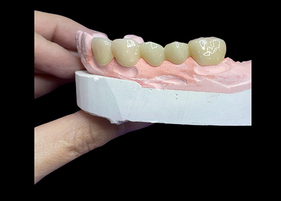 acheter Toutes les couronnes et ponts en céramique sont conçus pour une esthétique supérieure, une durabilité et une adéquation naturelle pour une confiance durable. online manufacture
