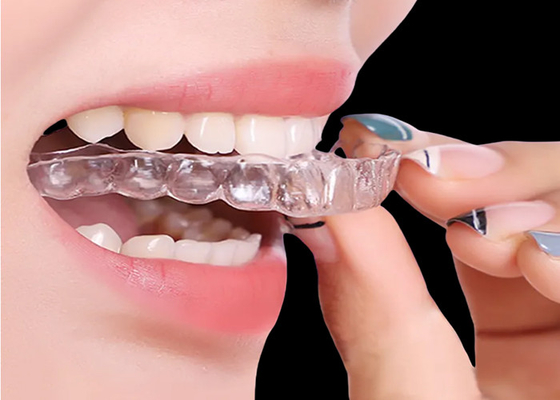 acheter Appareils orthodontiques pour un traitement rapide et efficace online manufacture