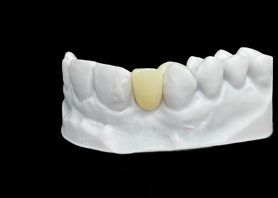 acheter Résistance aux fissures Couronne dentaire en zirconium d'une résistance et d'une translucidité exceptionnelles online manufacture