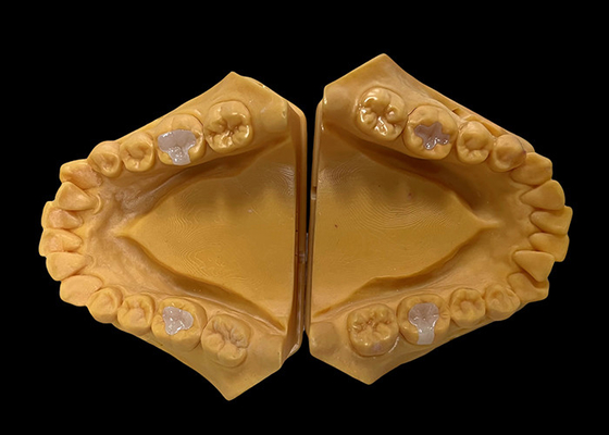acheter Inlays en céramique biocompatibles Onlays de restauration dentaire sans couture avec résistance aux taches online manufacture