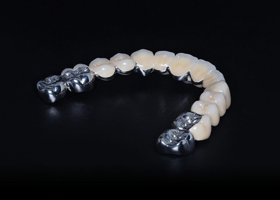 acheter Porcelaine biocompatible de haute durabilité fusionnée à une couronne métallique online manufacture