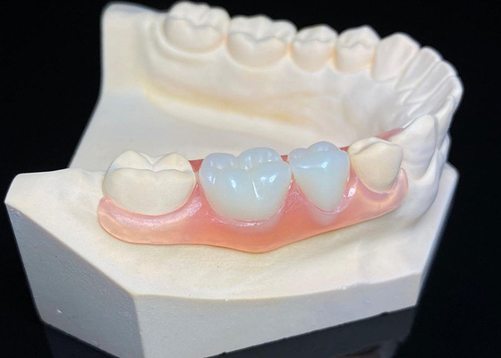 acheter OEM Prothèses dentaires amovibles invisibles Prothèses dentaires partielles en résine acrylique personnalisées online manufacture