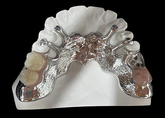 acheter Prothèse partiellement amovible en fonte personnalisable avec résine acrylique / conception de base métallique online manufacture