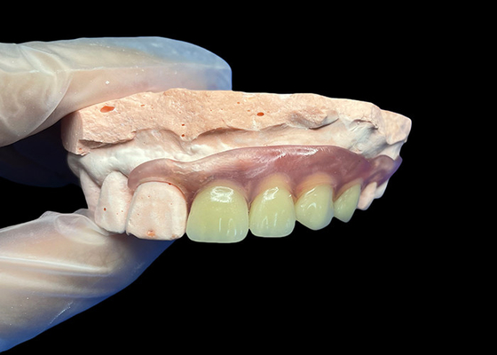 acheter Prothèses partielles invisibles et flexibles pour un ajustement confortable, sûr et esthétique naturelle online manufacture