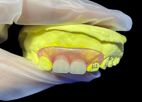 acheter Prothèse paritale flexible pour mâcher et parler confortablement online manufacture