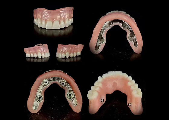 acheter Implantation de barre de précision Prothèse hybride supportée Adaptation sécurisée Stabilité réglable online manufacture
