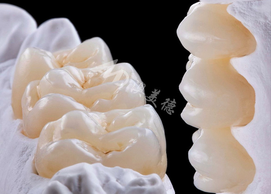 acheter Couronne dentaire en zirconium de haute résistance pour le remplacement d'une ou de plusieurs dents online manufacture