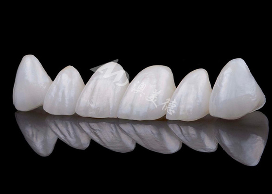 acheter La couronne dentaire en zirconium à l' apparence naturelle résiste aux taches, la couronne en zirconium online manufacture