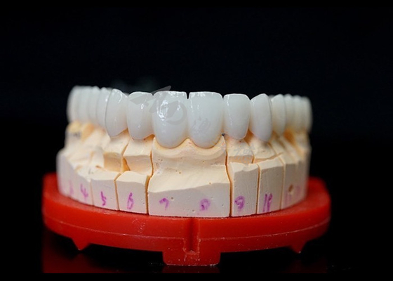 acheter Des couronnes en zirconium parfaitement ajustées, des couronnes en zirconium hautement biocompatibles pour les dents. online manufacture