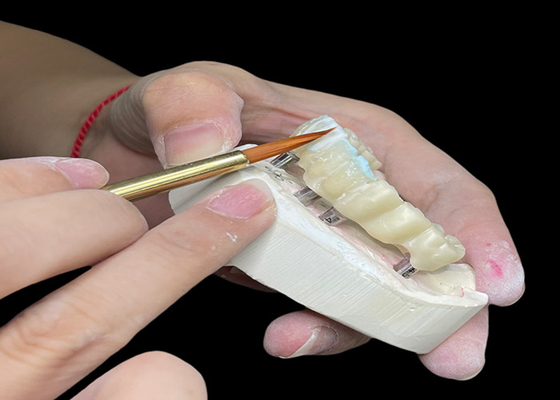 acheter Implantation dentaire polie personnalisable pont de couronne durable pour une hygiène facile online manufacture