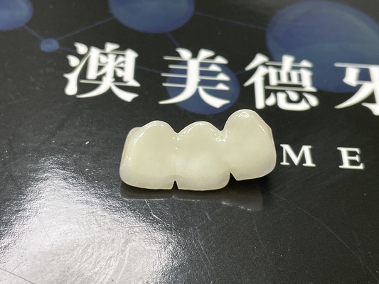 acheter Pont de couronne en céramique de taille précise avec une porcelaine solide et une translucide esthétique naturelle online manufacture