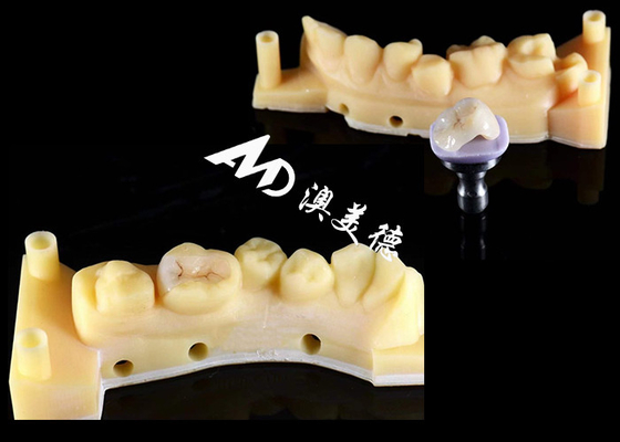 acheter Encrés en céramique hypoallergénique lisse Encrés personnalisés Résistance aux taches Haute durabilité online manufacture