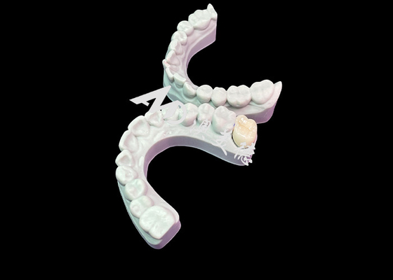 acheter Précisément ajusté Couronne dentaire en zirconium Esthétique Couleur naturelle Excellente biocompatibilité online manufacture