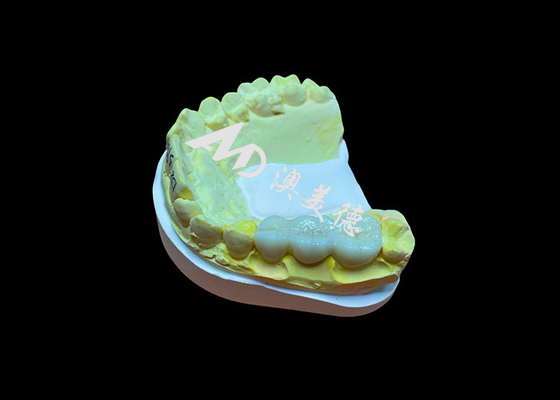 acheter Surface lisse personnalisée couronne dentaire en zirconium haute biocompatibilité résistance aux taches online manufacture