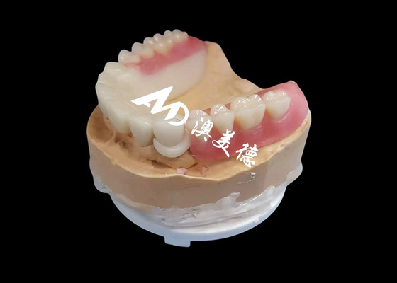 acheter Prothèse partielle personnalisée Hpp cadre acrylique amovible pour dents manquantes online manufacture