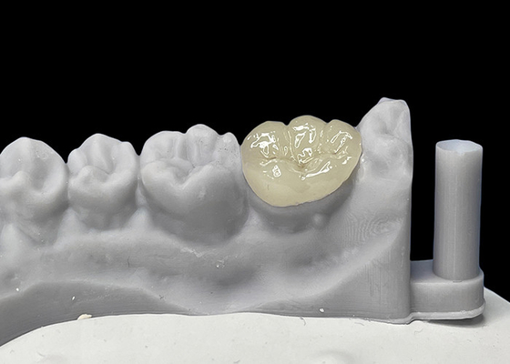 acheter Des incrustations en céramique, en porcelaine et en dentisterie, approuvées par la FDA. online manufacture