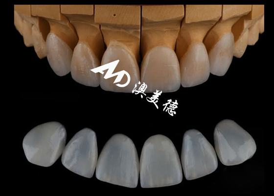 acheter Veneurs Emax personnalisés de haute précision / Veneur dentaire en porcelaine pour la dentisterie cosmétique online manufacture