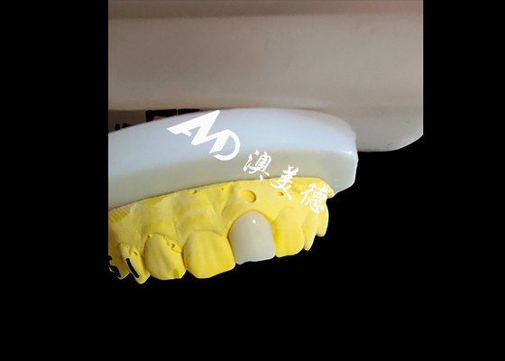 acheter Coronne dentaire en zirconium d' apparence naturelle et esthétique Restauration des dents en parfaite forme online manufacture