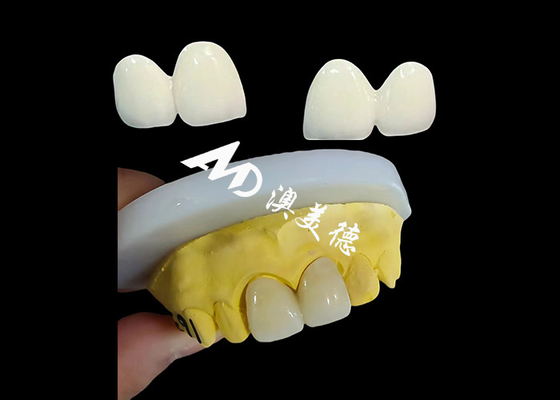 acheter Une couronne dentaire en zirconium personnalisée, une casquette de dentition en Chine. online manufacture