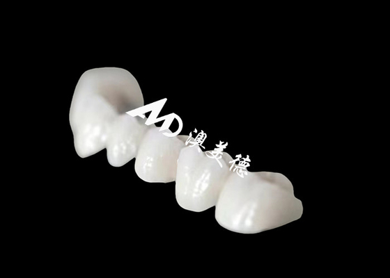 acheter Une couronne dentaire en Zriconia à arche pleine à l'aspect naturel étonnant online manufacture