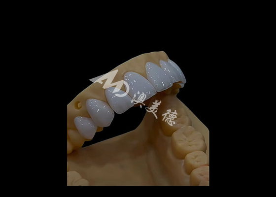acheter Prothèses dentaires Circonia Couronne dentaire Précise esthétique pour les dents à arc complet online manufacture