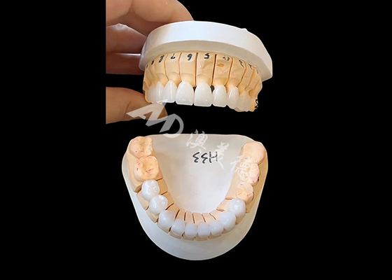 acheter Couronne dentaire en zirconium de translucide améliorée pour les restaurations fixes à un ou plusieurs appareils online manufacture