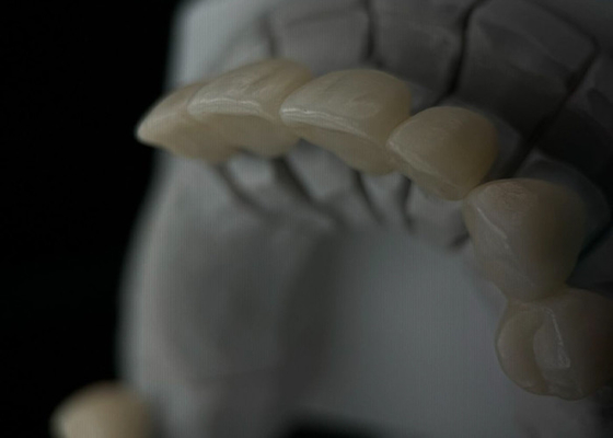 acheter Une couronne dentaire en zirconium monolithique, translucide et résistante online manufacture