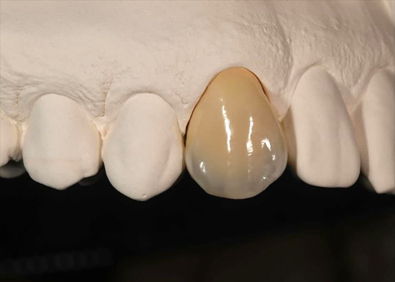 acheter Résistance à la coloration Couronne en zirconium solide pour les dents avant et les dents postérieures online manufacture