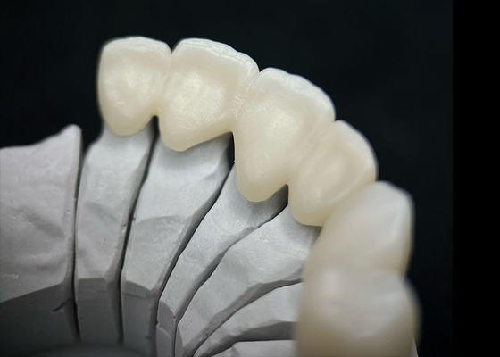 acheter Une couronne dentaire en zirconium solide qui offre une résistance exceptionnelle et une esthétique naturelle online manufacture
