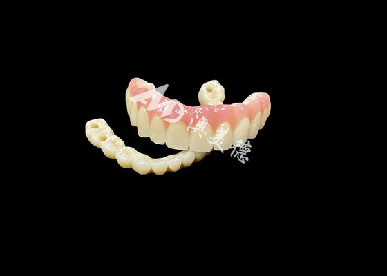 acheter La solution dentaire ultime pour les dents manquantes online manufacture