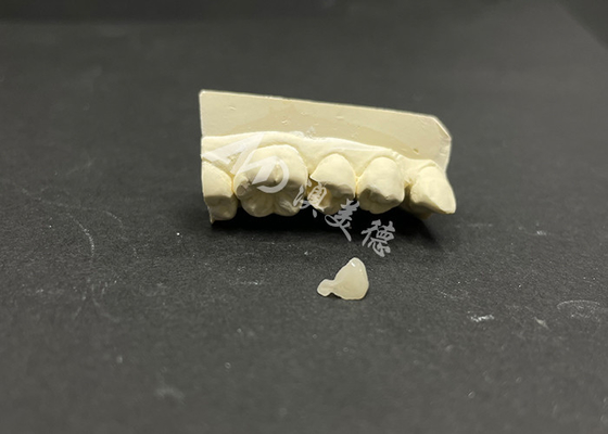 acheter Incrustation céramique Emax hypoallergénique résistante aux taches pour la réparation précise des dents endommagées online manufacture
