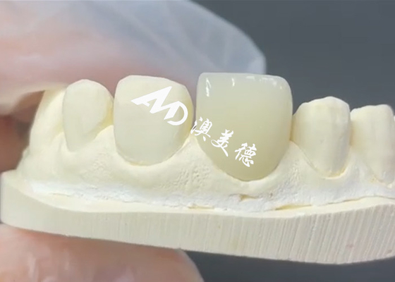 acheter Veneur EMAX durable et esthétique La solution parfaite pour les restaurations de porcelaine online manufacture