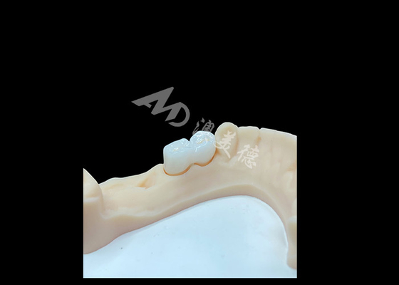 acheter Une couronne en zirconium solide de grande qualité pour des restaurations dentaires satisfaisantes online manufacture