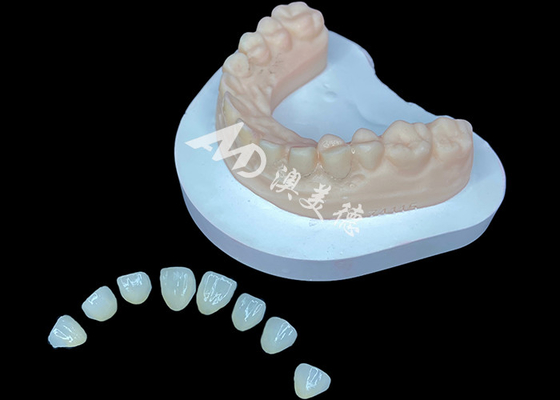 acheter La solution esthétique IPS e.max Veneer Premium pour des transformations de sourire étonnantes online manufacture