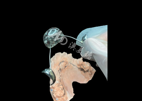 Bon prix Appareil d'orthodontie de Nance Optimale solution de stabilisation de la mâchoire et d'entretien de l'espace en ligne