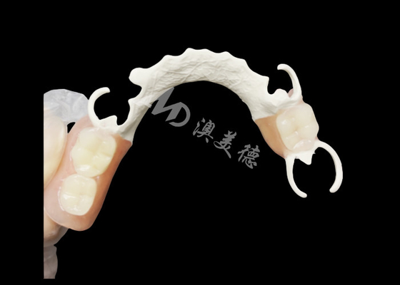 acheter Prothèse partielle coulée sur mesure avec cadre HPP pour une meilleure mastication et une meilleure parole online manufacture