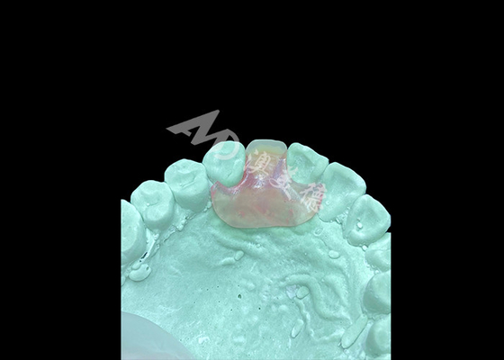 acheter Prothèse souple Nesbit légère et confortable pour le remplacement d'une seule dent online manufacture