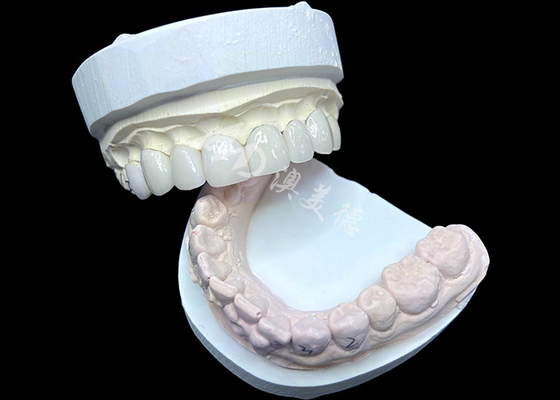 acheter Les placages IPS e.max à l'ombre BL2 atteignent une esthétique naturelle étonnante avec 8 unités parfaitement conçues online manufacture