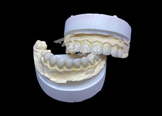 acheter Personnalisation des facettes en céramique de verre ultra-minces, haute translucidité online manufacture