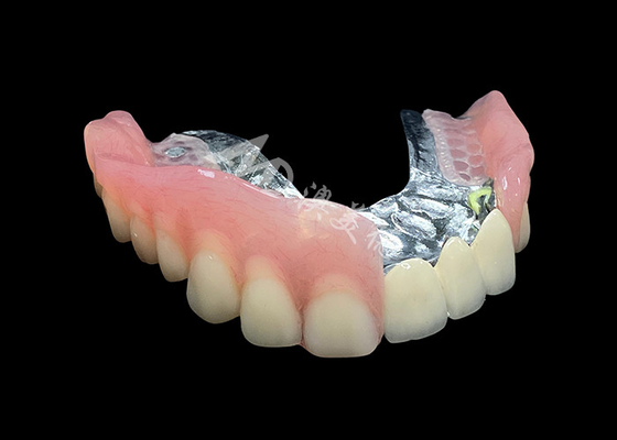 acheter Améliorez votre sourire avec un pont de couronne PFM et des prothèses amovibles online manufacture