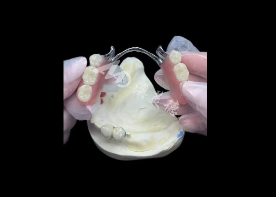 acheter Porcelaine durable fondue dans du métal couronne dentaire PFM couronne pour la restauration online manufacture