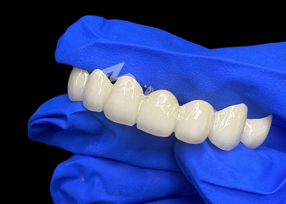 acheter Lave à haute translucide Zirconia pont dentaire mélange sans couture avec des dents naturelles online manufacture
