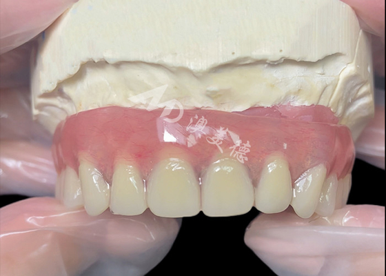 acheter Implanté en titane supporté Bar attachement Prothèses dentaires de laboratoire dentaire en Chine online manufacture