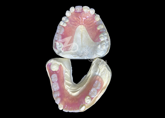 acheter Une prothèse partielle flexible Valplast pour un confort et une esthétique optimaux online manufacture