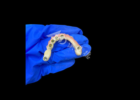 acheter Dentures en titane et couronne en zirconium avec support d'implant Précision adaptée à un usage confortable online manufacture